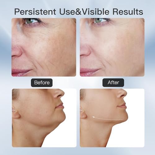 Vue 7 de Interieur Appareil Anti Rides