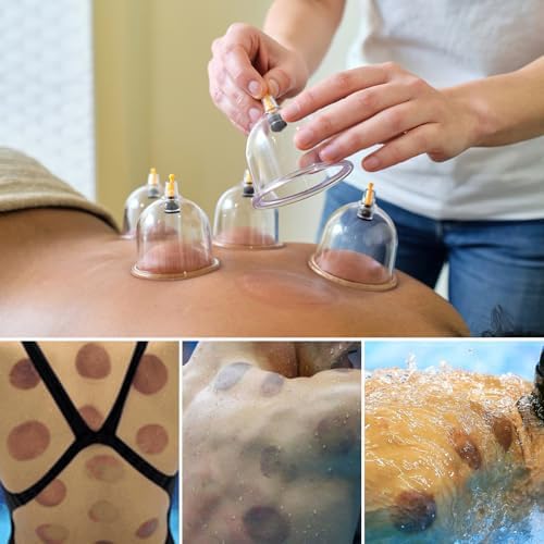 Vue 6 de Cupping Therapy Ventouse Chinoise
