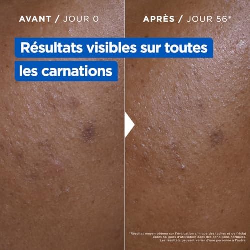 Vue 6 de Mixa Creme Niacinamide Correction