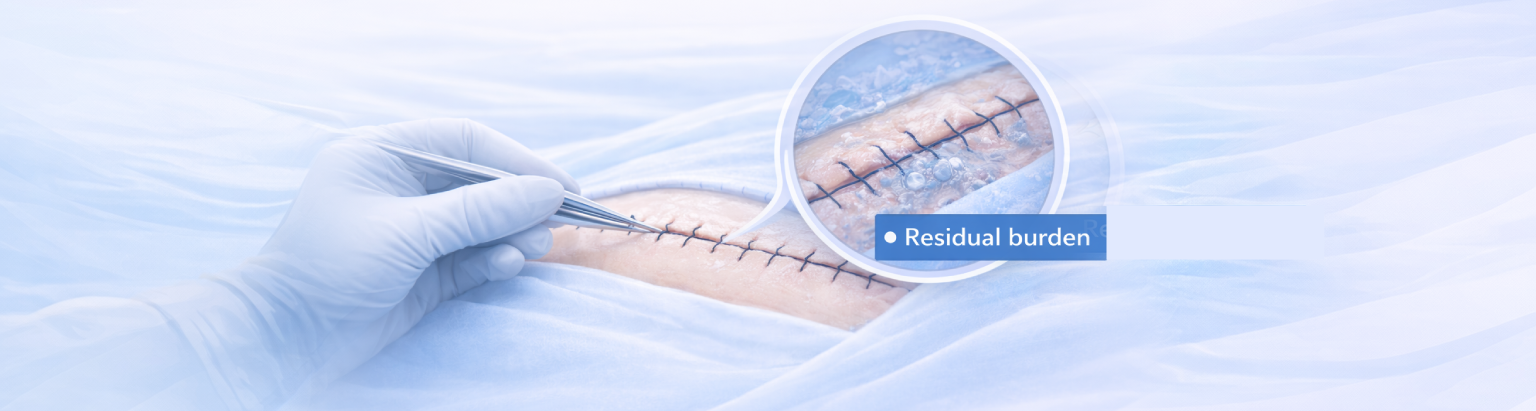 Residual bacterial burden illustration