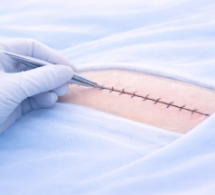 Routine orthopedic models