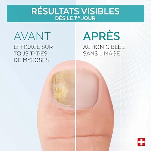 Vue 3 de Poderm Mycose Ongle Traitement