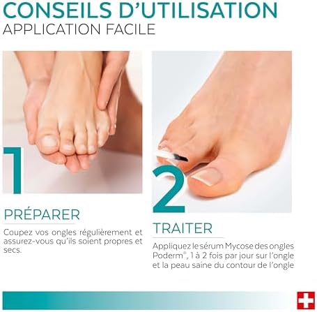 Vue 6 de Poderm Mycose Ongle Traitement