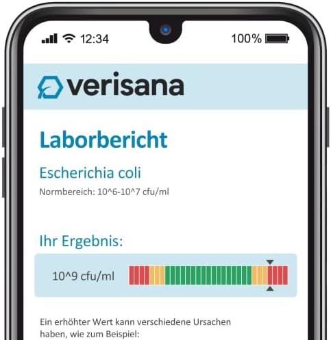 Vue 2 de Test De Flore Intestinale