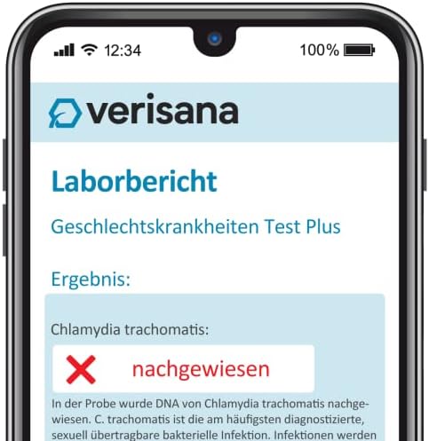 Vue 2 de Test De Maladies Veneriennes