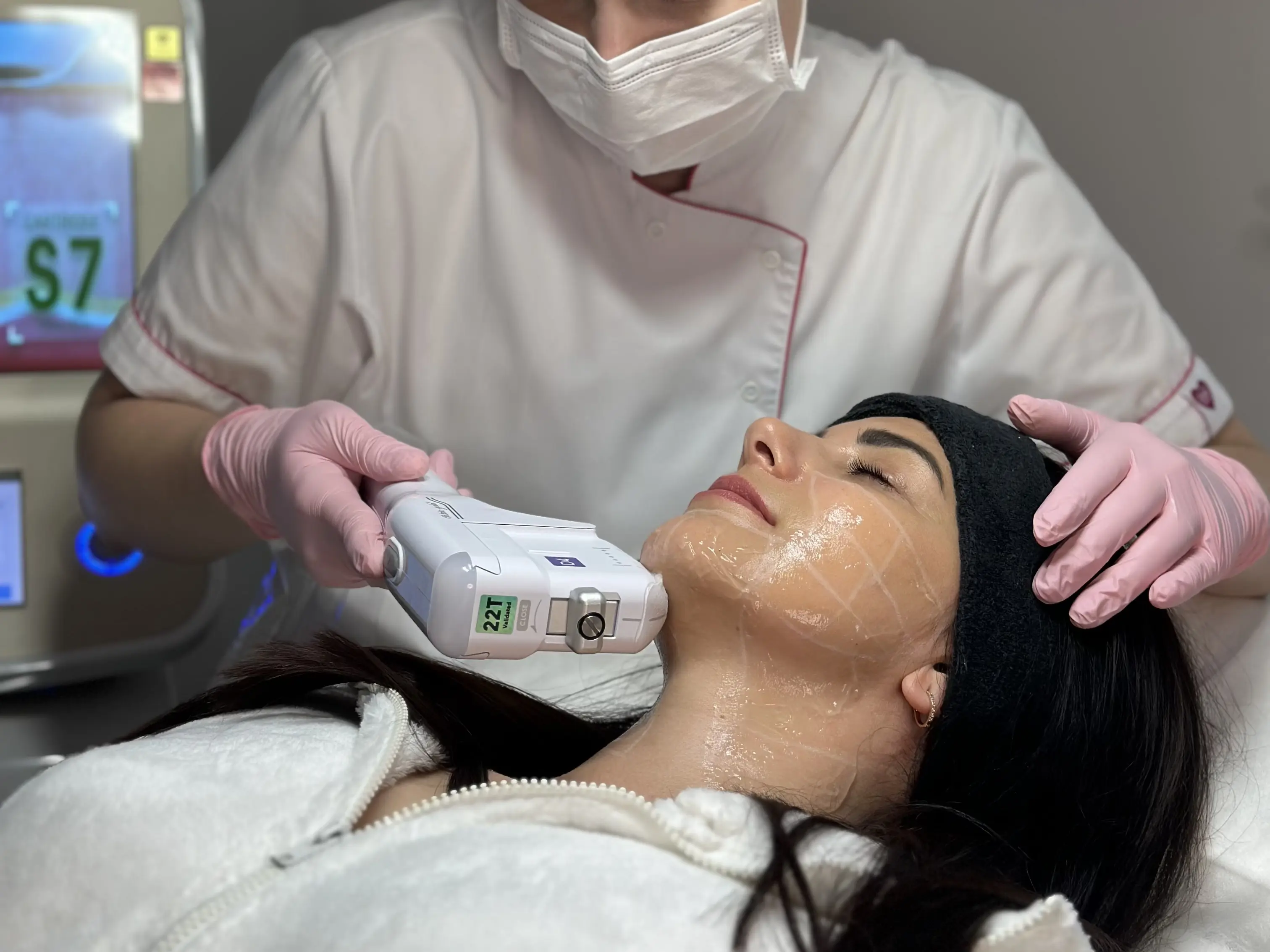 SMAS lifting – omlazení obličeje bez zásahů