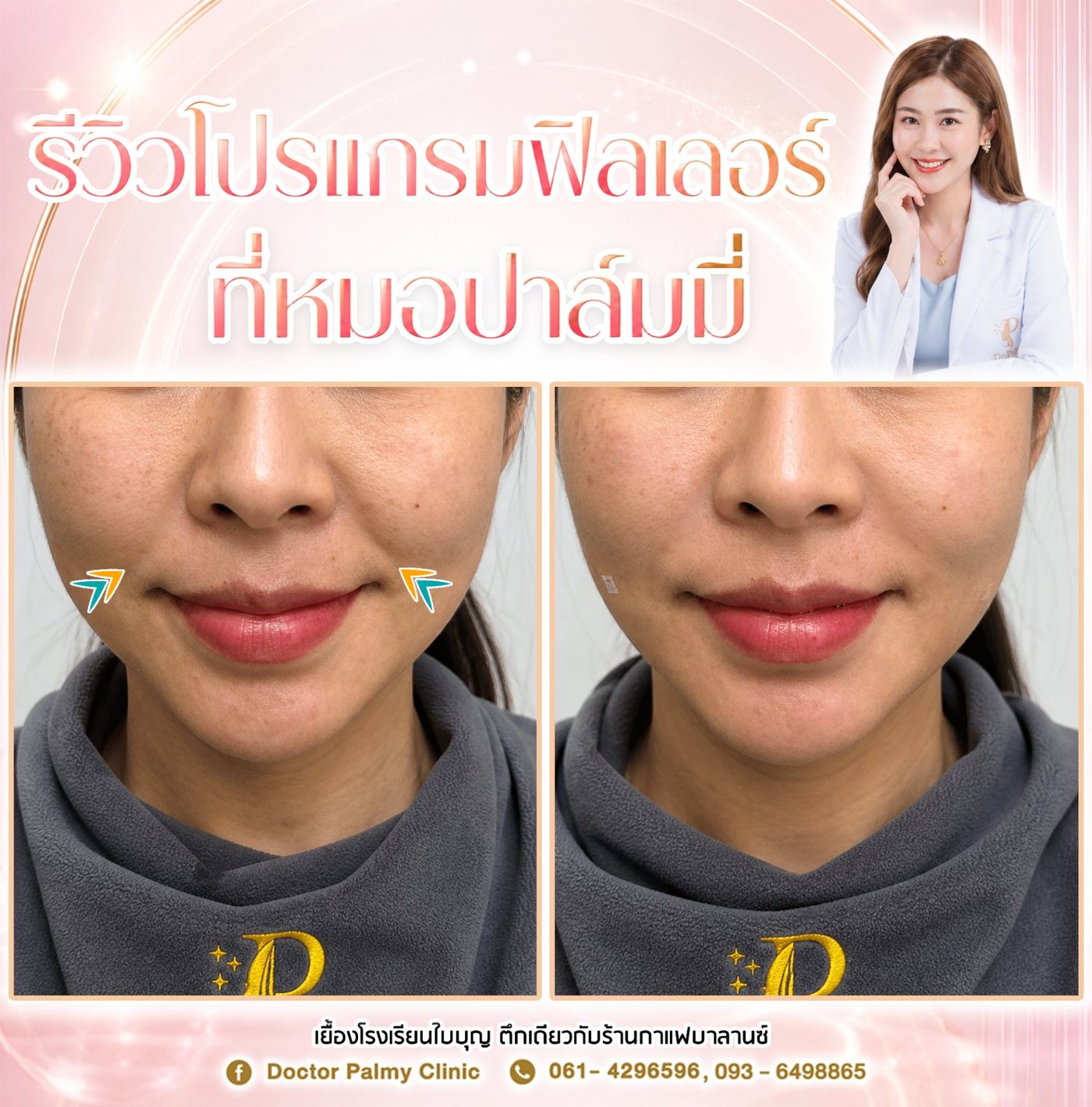 เคสจริง 