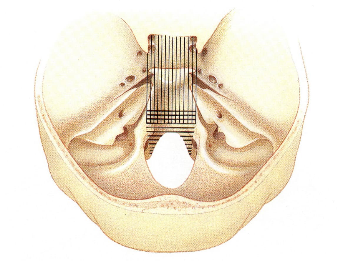 Anterior Approaches to the Clivus | Jackler Collection | Volumes | The ...