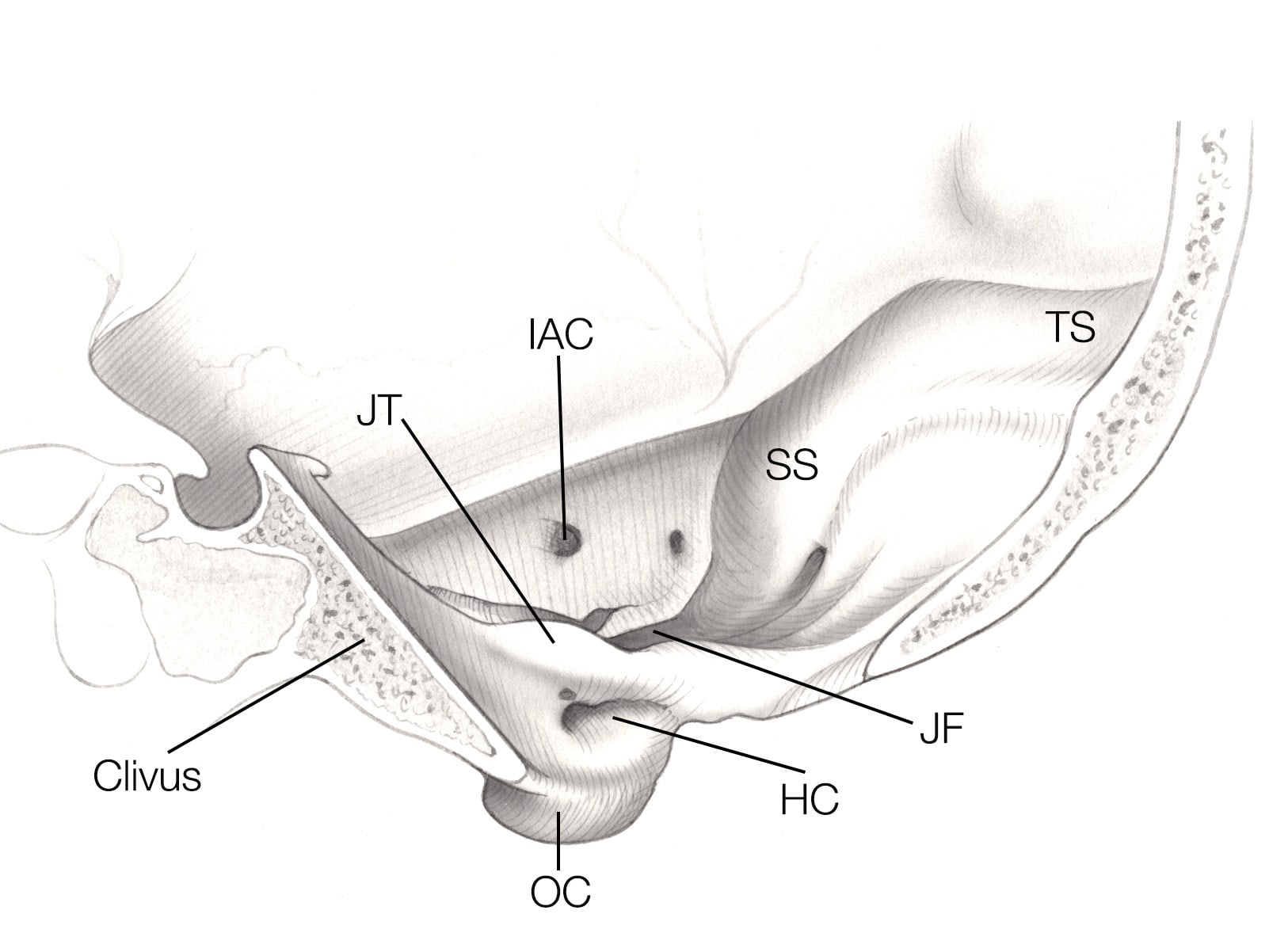 Jugular Foramen Approaches | Jackler Collection | Volumes | The ...