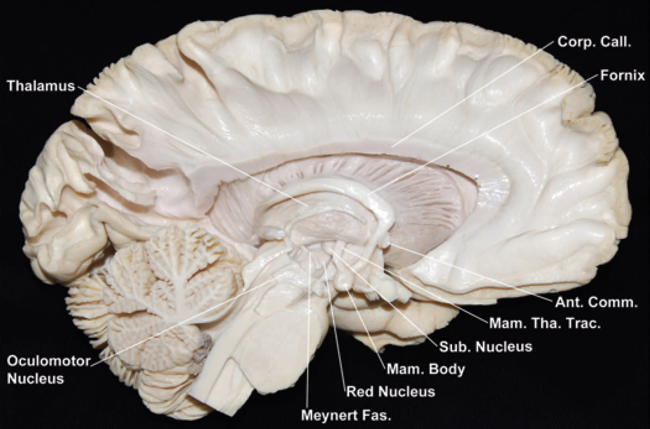 Medial Surface of the Left Hemisphere and Brainstem | Neuroanatomy ...