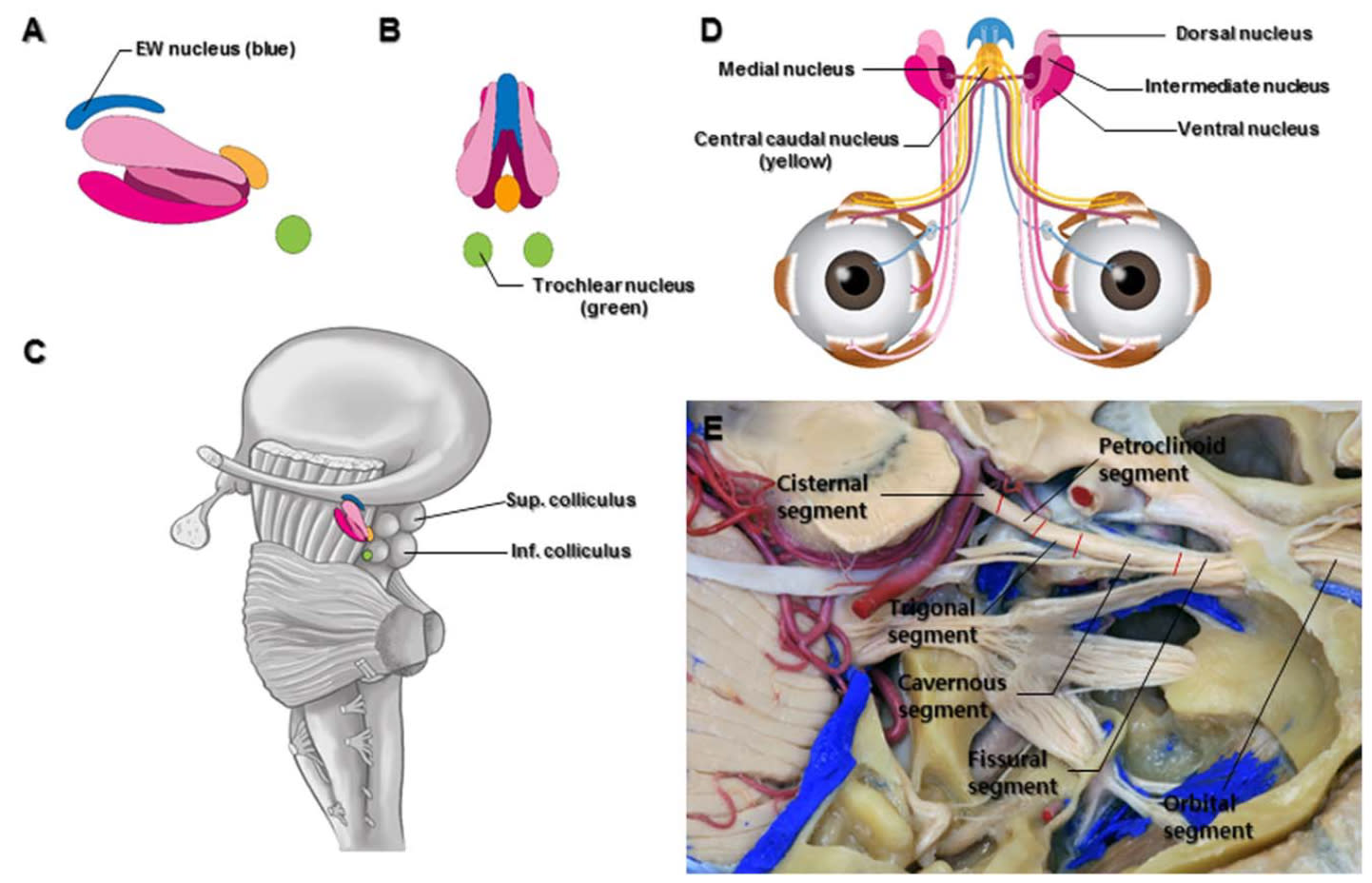 Oculomotor Nerve | Cohen Collection | Volumes | The Neurosurgical