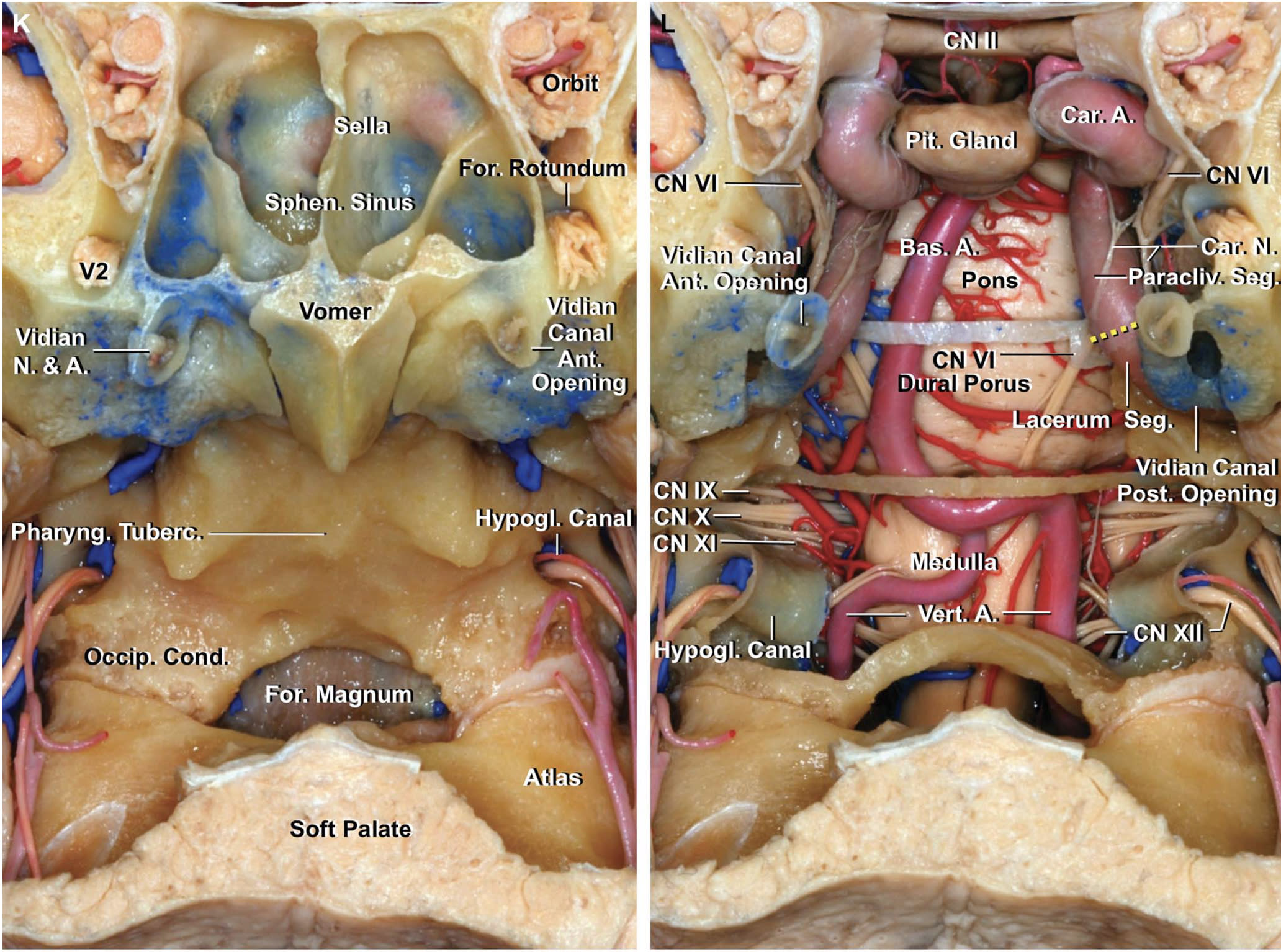 Enlarged Anterior Views of the Midline Cranial Base Before and