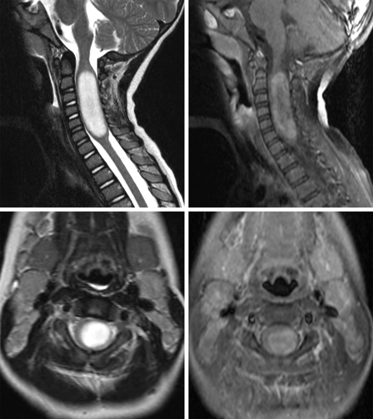 TNM Staging Atlas With Oncoanatomy: 9781609131449: Medicine