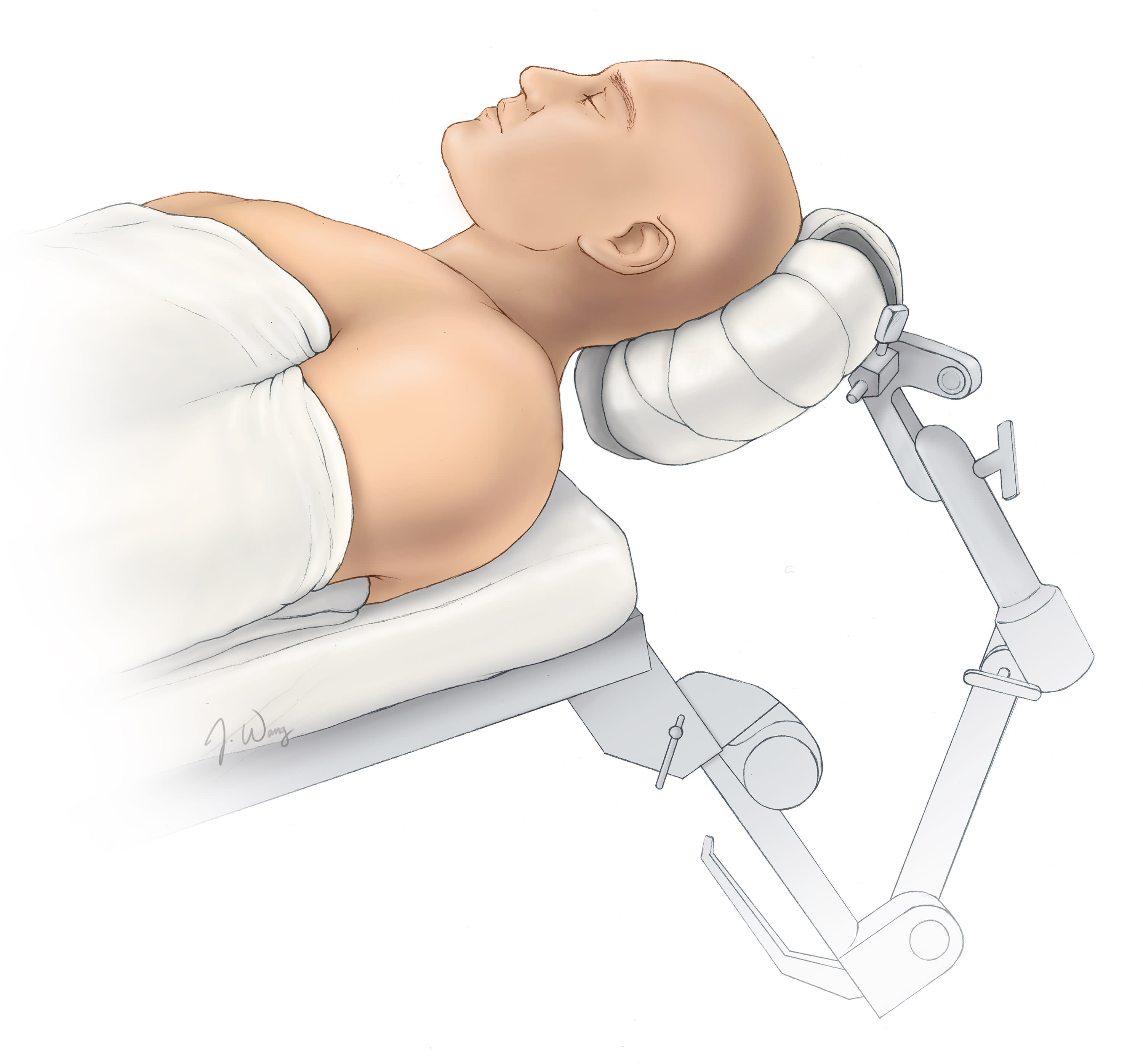 Microscope-Guided Endonasal Transsphenoidal Approach | Cohen Collection ...