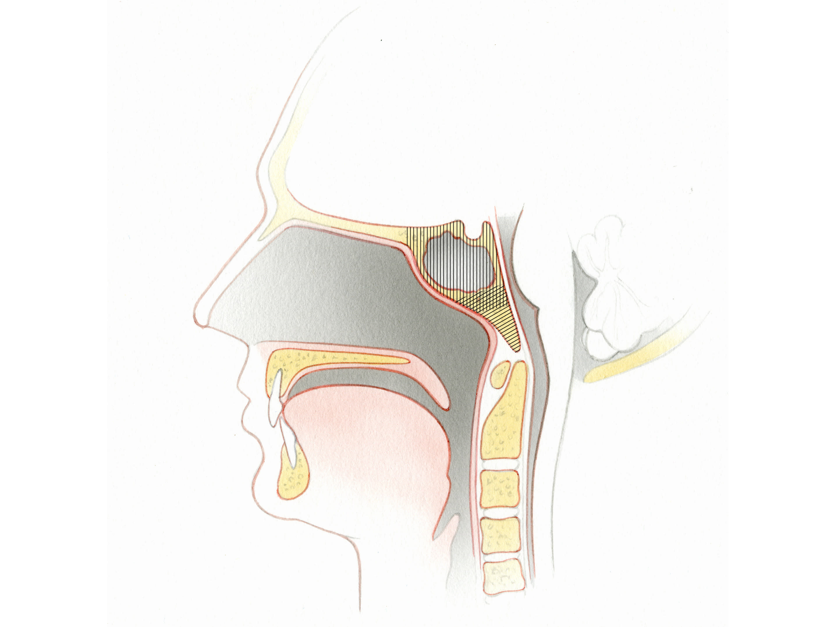 Anterior Approaches to the Clivus | Jackler Collection | Volumes | The ...