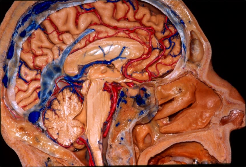 Midsagittal View of the Skull Base | Neuroanatomy | The