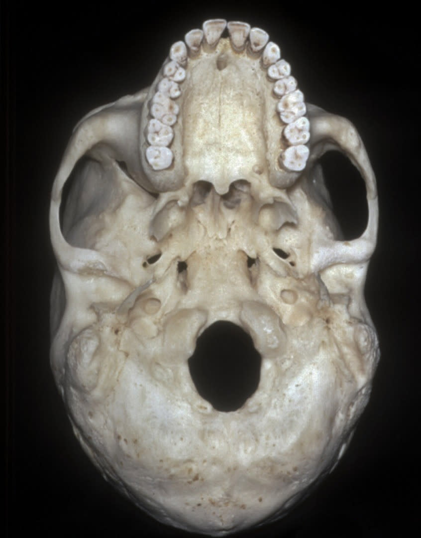 Inferior View of Skull Base | Neuroanatomy | The Neurosurgical Atlas