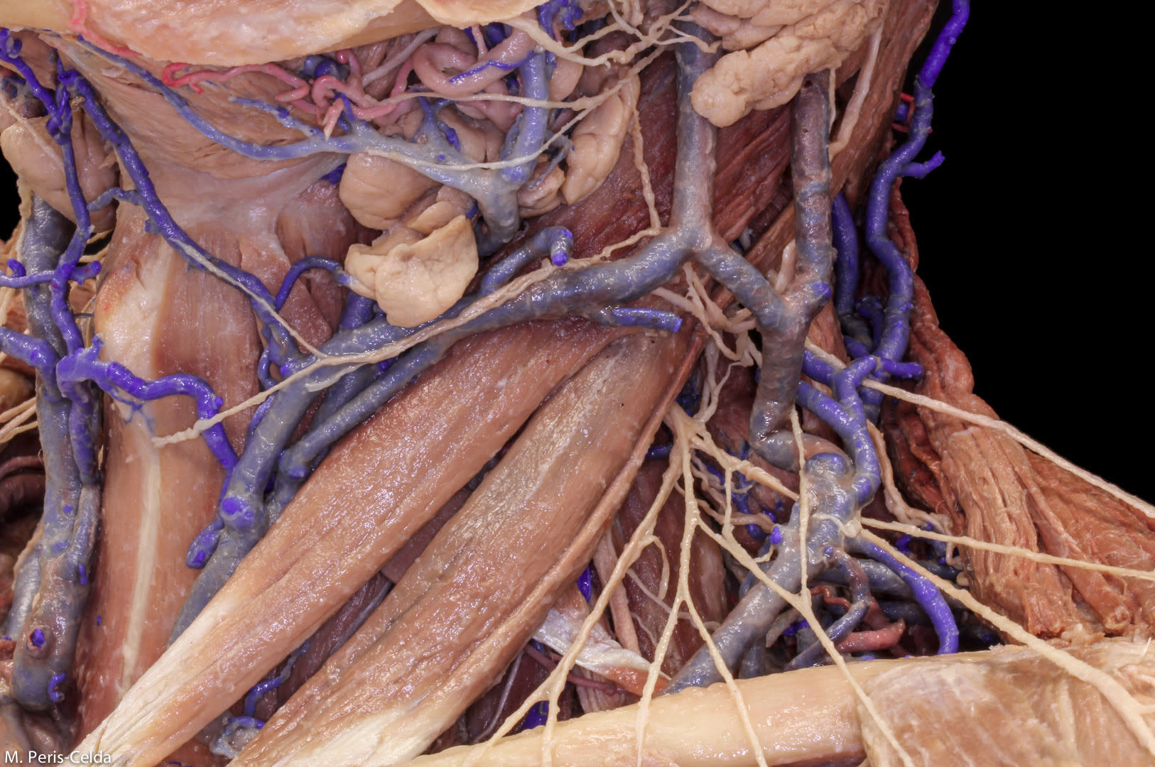 Triangles of the Neck | Neuroanatomy | The Neurosurgical Atlas