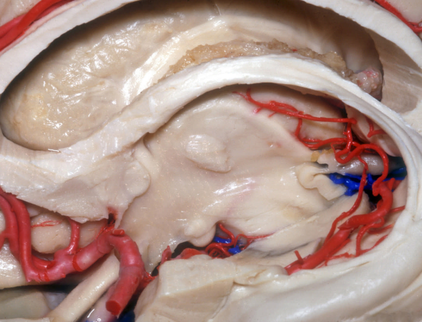 Midline Deep Brain Anatomy | Neuroanatomy | The Neurosurgical Atlas