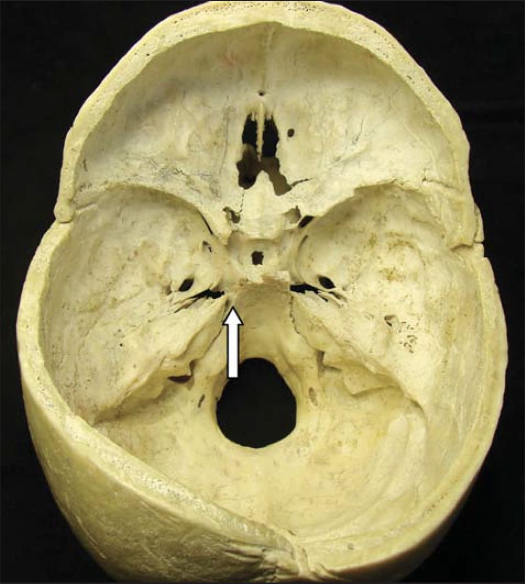 Superior View of the Skull Base | Neuroanatomy | The Neurosurgical