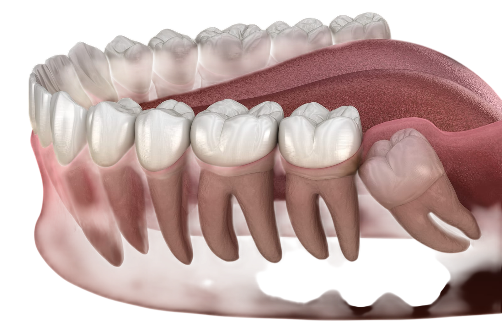 Everything You Need to Know About Wisdom Teeth