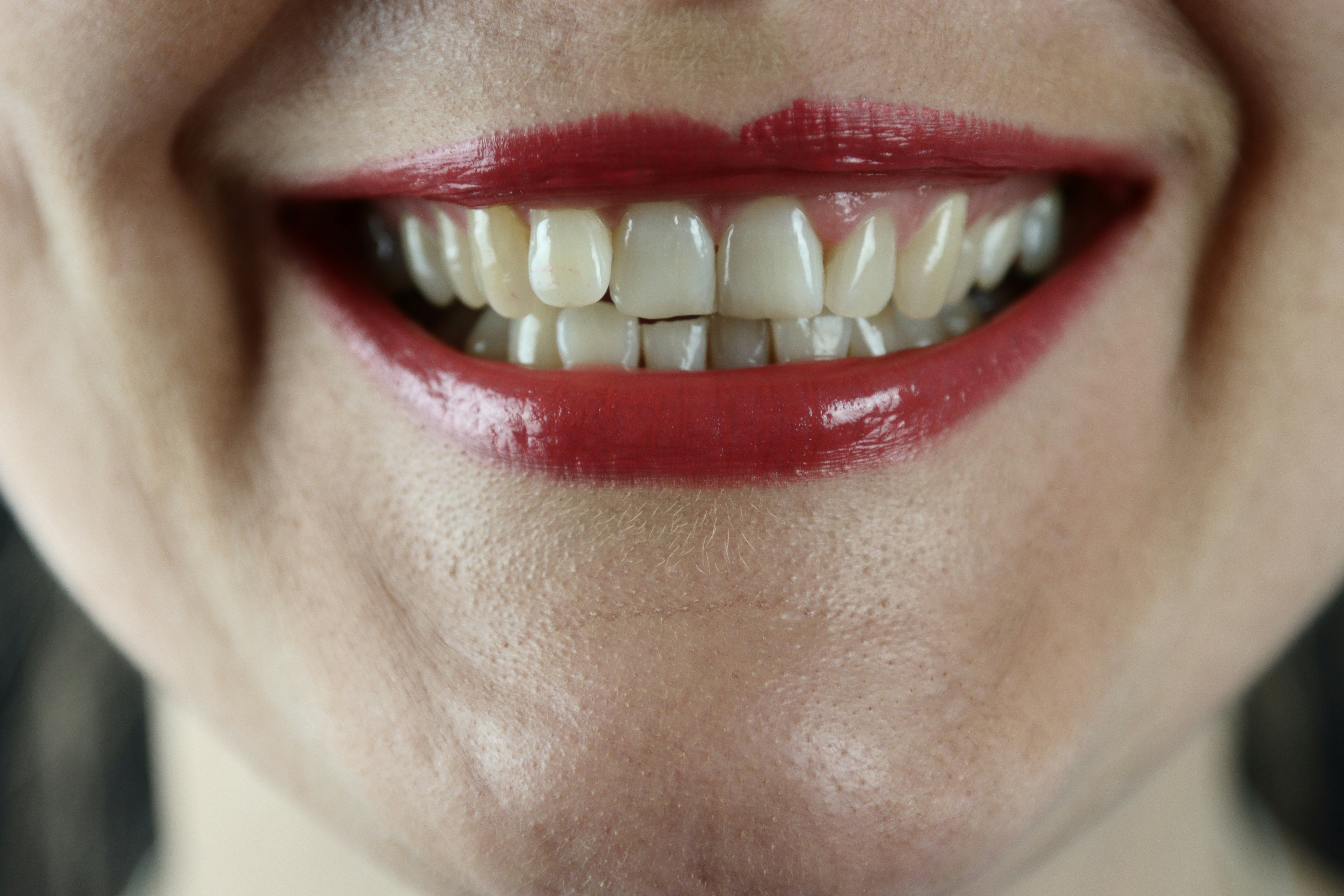 Tooth Stains: What Causes Them and How a Professional Clean Can Help