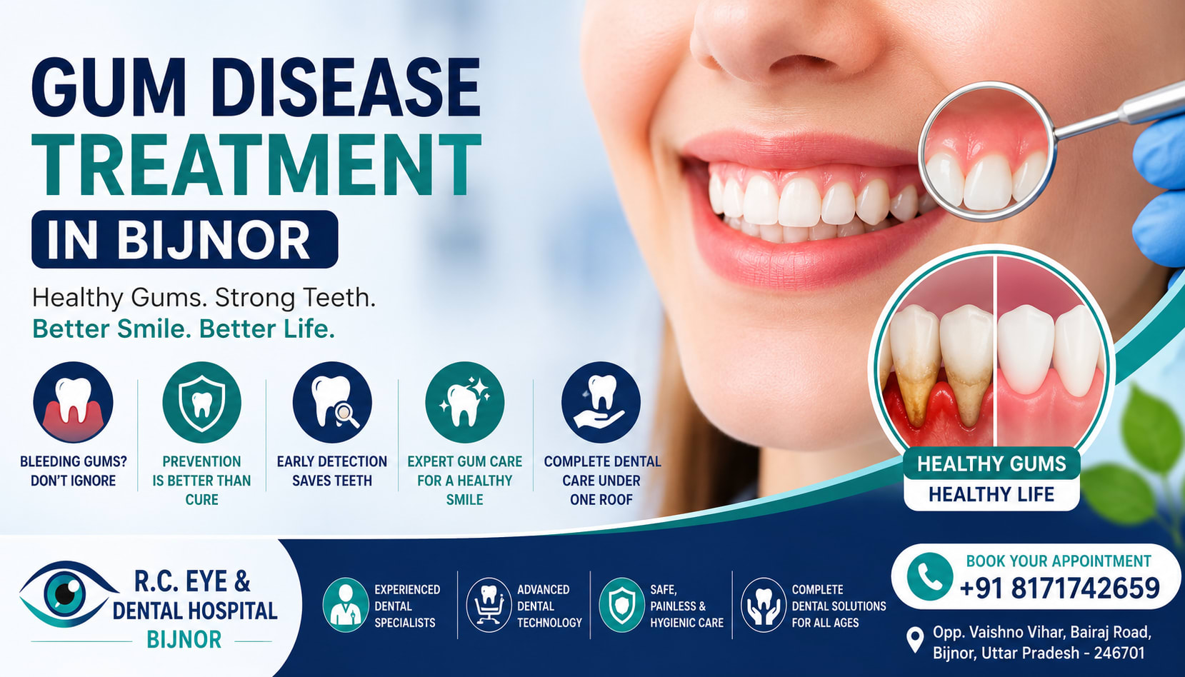 Gum Disease Treatment in Bijnor | Symptoms, Causes & Prevention