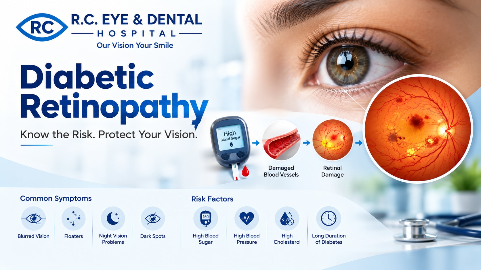 Diabetic Retinopathy: Symptoms, Causes, Treatment & Prevention
