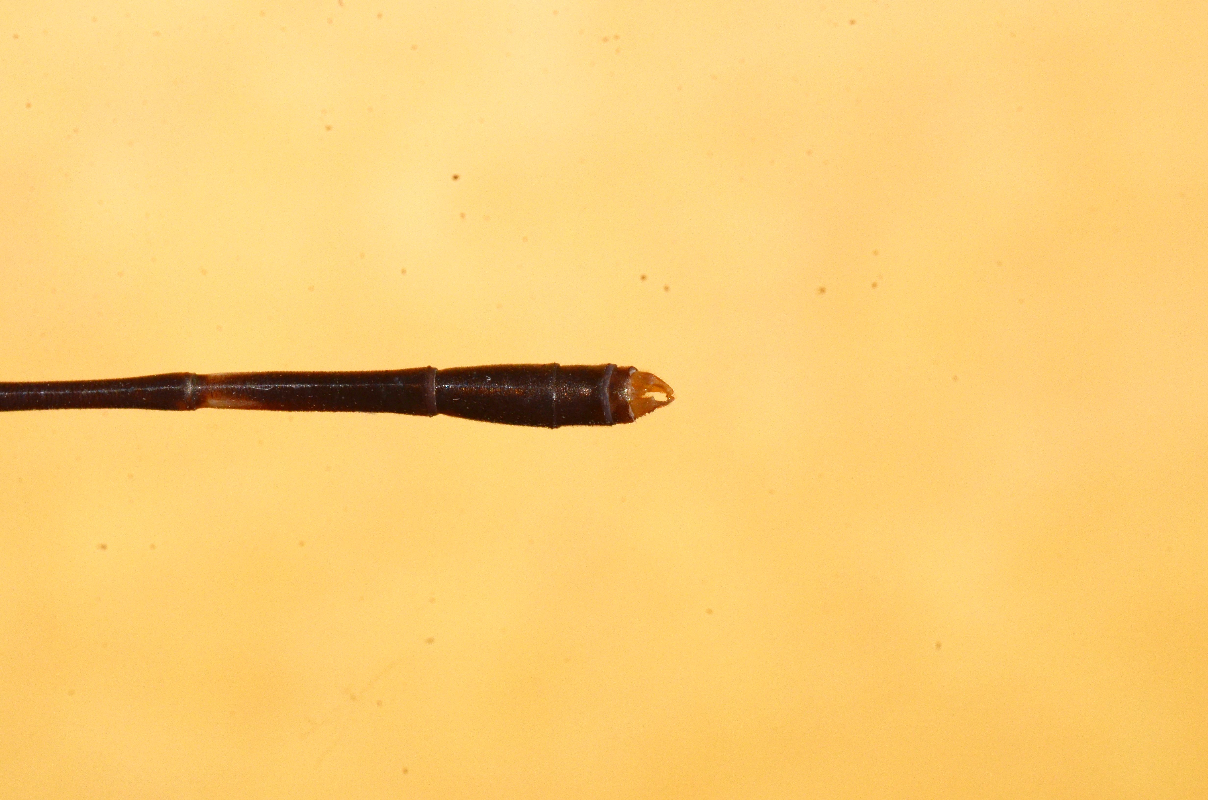 Anal Appendage