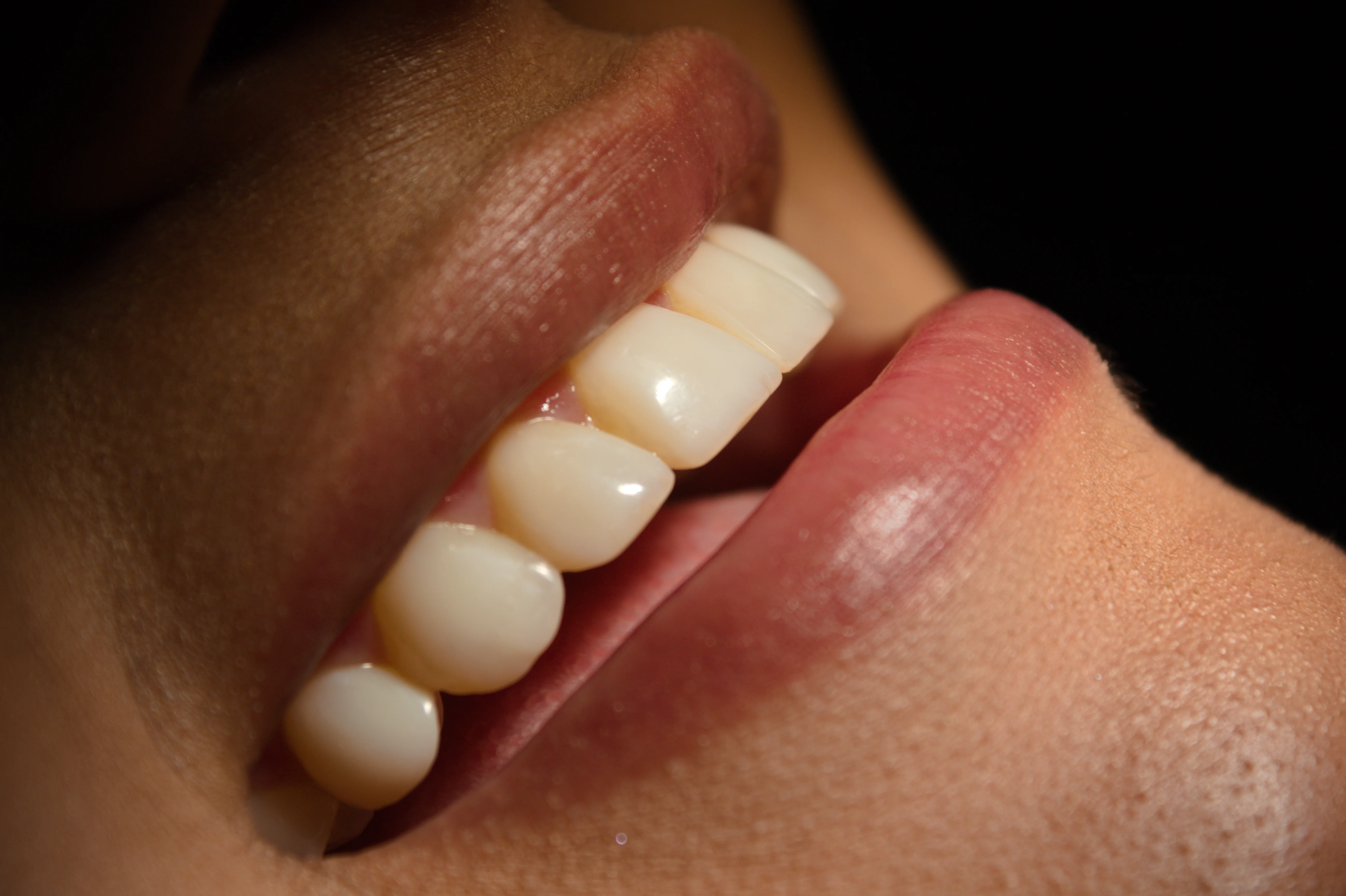 El Esmalte Dental: El Escudo Más Fuerte del Cuerpo