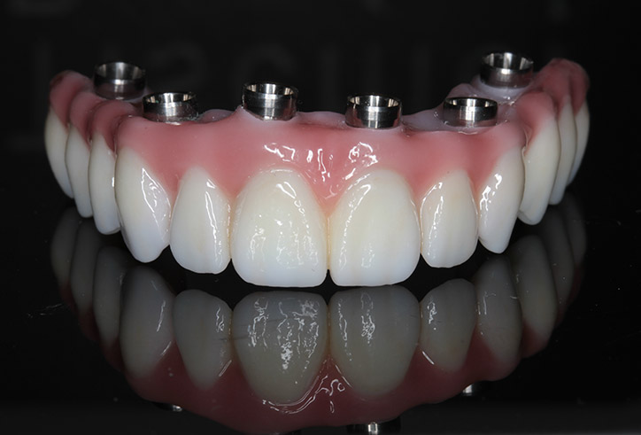 Laboratorio 3D Tu Dentista