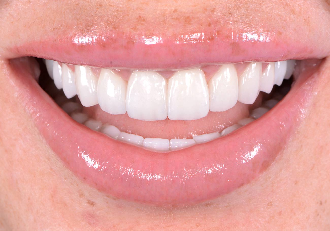 Blog Tu Dentista