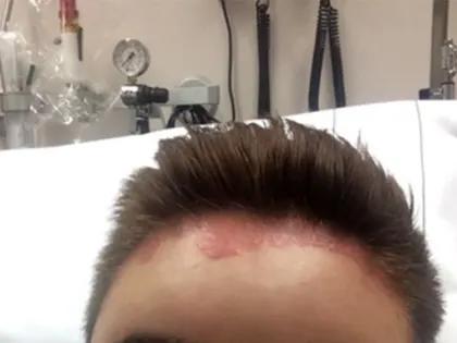 Новогодних страшилок прибыло: ребенок попал в больницу после неудачной бьюти-процедуры