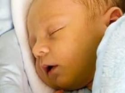 Желтуха новорожденного