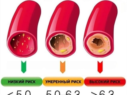 ЗАЧЕМ НУЖНО ПРОВЕРЯТЬ УРОВЕНЬ ХОЛЕСТЕРИНА ?