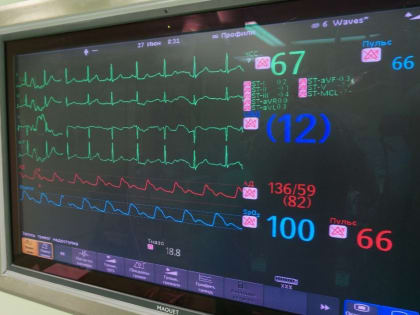 Уникальная операция: пермские кардиохирурги провели вмешательство на работающем сердце