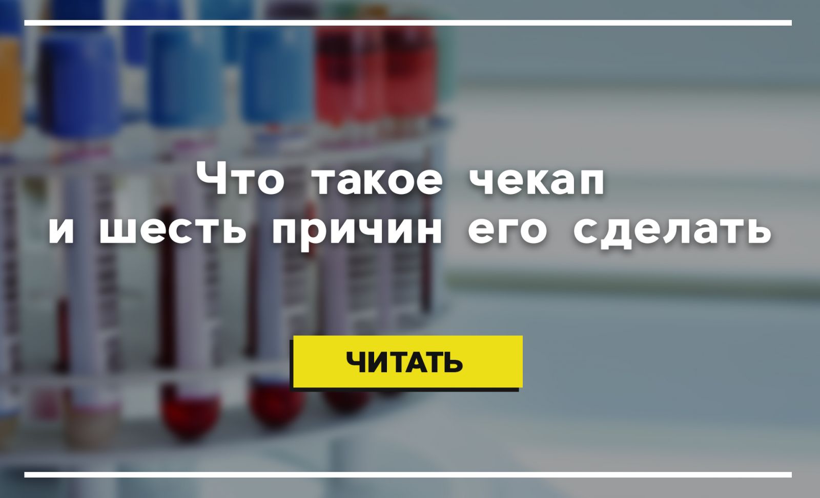 Чекап что это. Чекапы. Чекап Яндекс. Что такое чекапы в медицине. Чекап чекап в парках птичка.