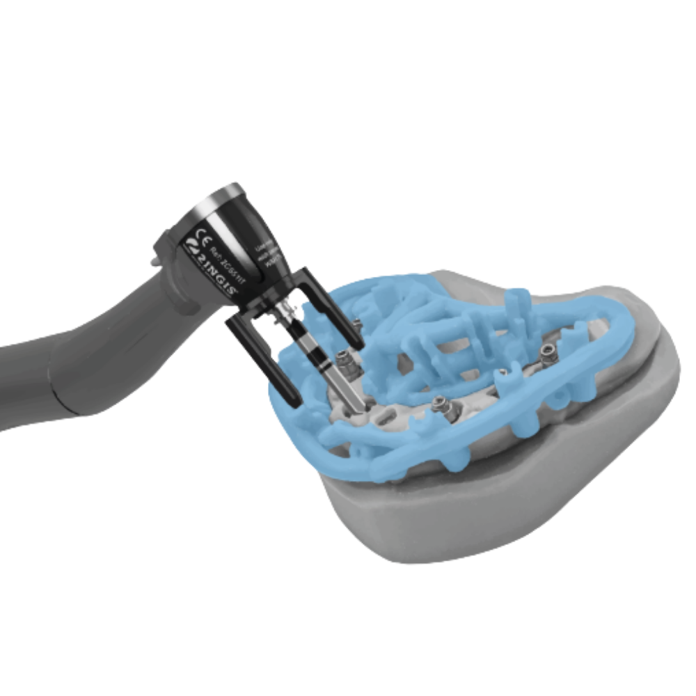 Open-frame guided surgery