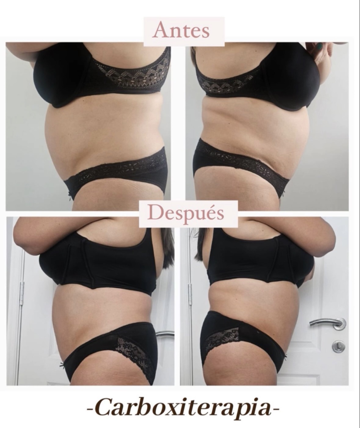 Antes y después - Corporal