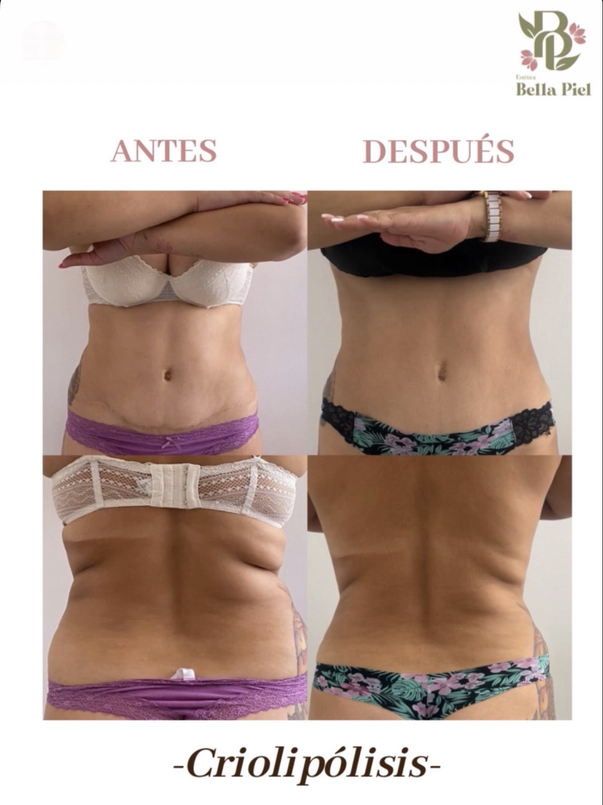 Antes y después - Corporal