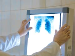 Фтизиатры из Сергиева Посада доказали влияние прививки БЦЖ на здоровье