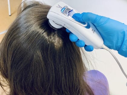 Советы по лечению себорейного дерматита от дерматолога