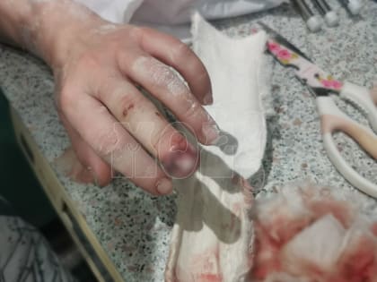 «Откусили фалангу пальца»: на женщину и её сына напали пьяные мужчины в Воронеже 