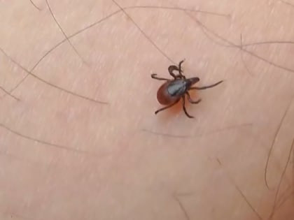 Клещи умерили аппетиты и кусают костромичей заметно реже