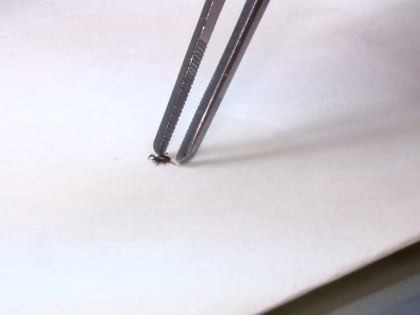 За неделю от укусов клещей пострадали 55 жителей Костромской области