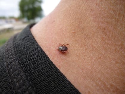 За неделю от укусов клещей пострадали 1360 костромичей