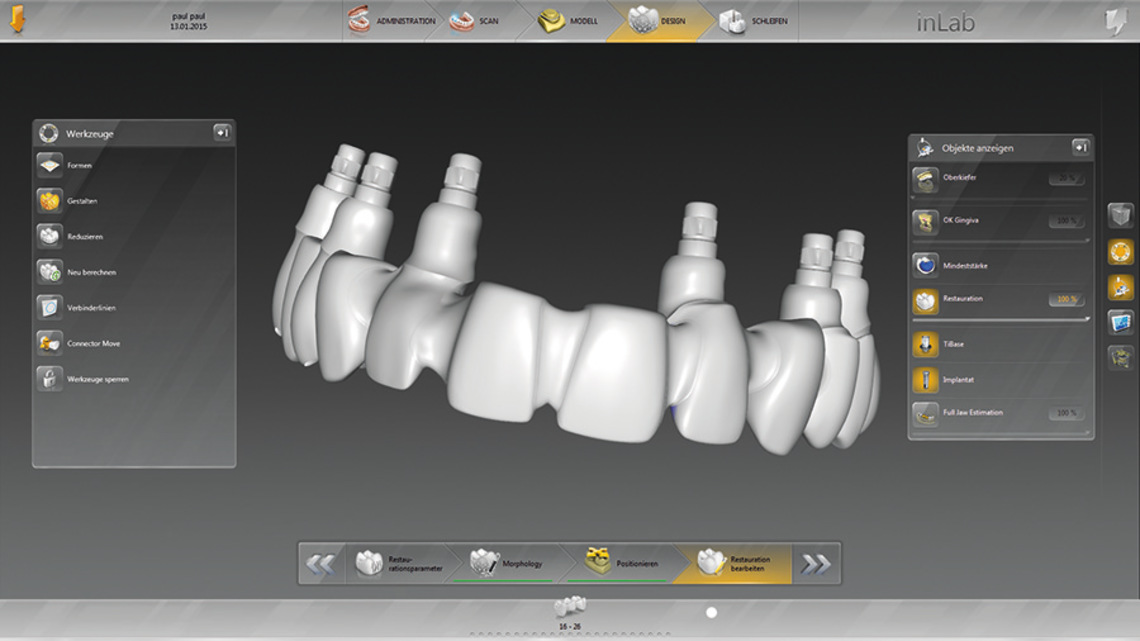 INLAB Software 15.0