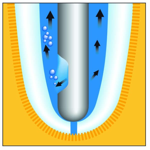 SKYLLEKANYLER BUTT PROBE 25G 0.5X25 MM ORANGE 40STK KERR