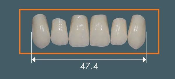 NOVO LIGN A I47 BL3 INC OK