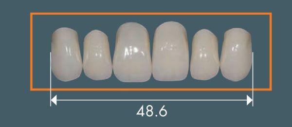 NOVO LIGN A D49 BL3 INC OK
